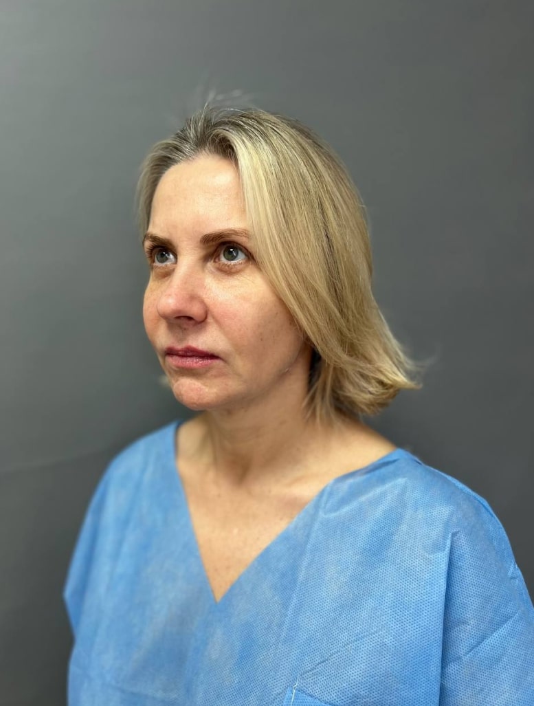 Лифтинг по Мендельсону, доктор Крылов М.С